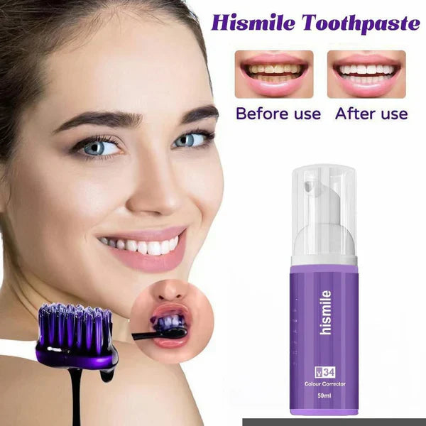 Hismile™ V34 Teeth Whitening Paste | Buy One Get One Free!